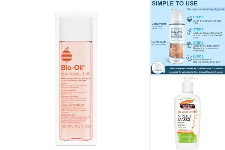 Detailed view of Best Stretch Mark Treatments